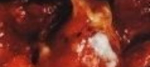 Яблоки в желе