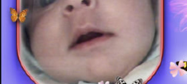 Запеканка из кабачков и картофеля